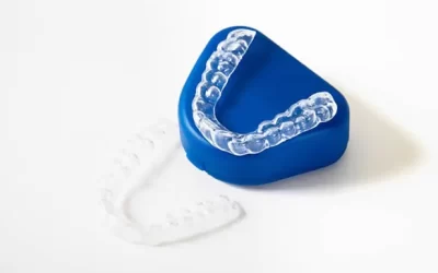 Sports and Orthodontics in North Hills: Protecting Your Teeth and Jaw During Physical Activity